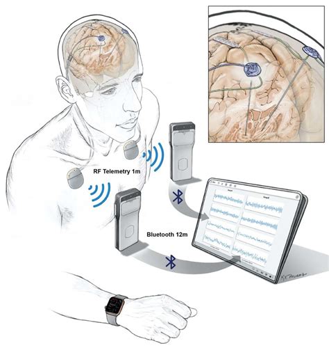 Remote neural monitoring facilities have been located. . Remote neural monitoring